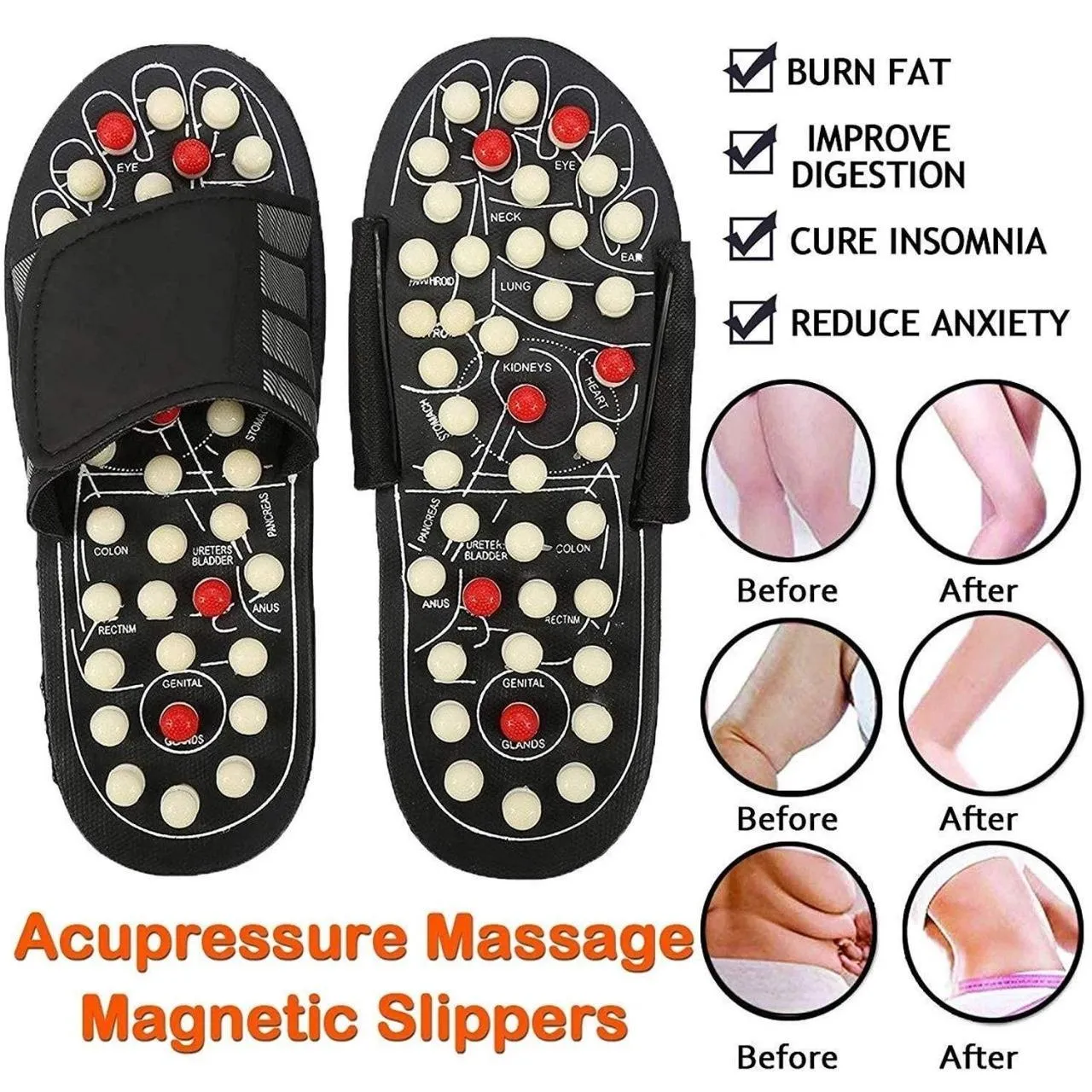 Acupressure Massage Slippers – Reflexology Footwear for Pain Relief